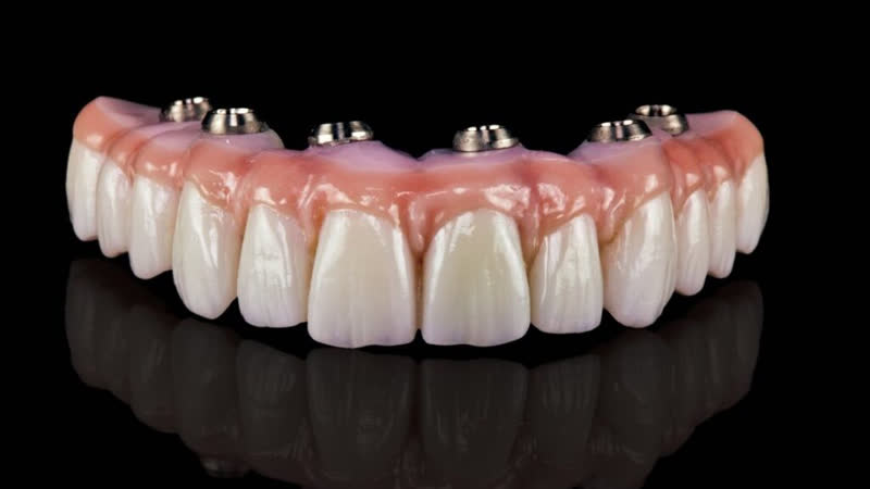An image of a set of human teeth with a pinkish hue, showcasing a large smile with multiple rows of teeth, including front teeth with a gap between them.
