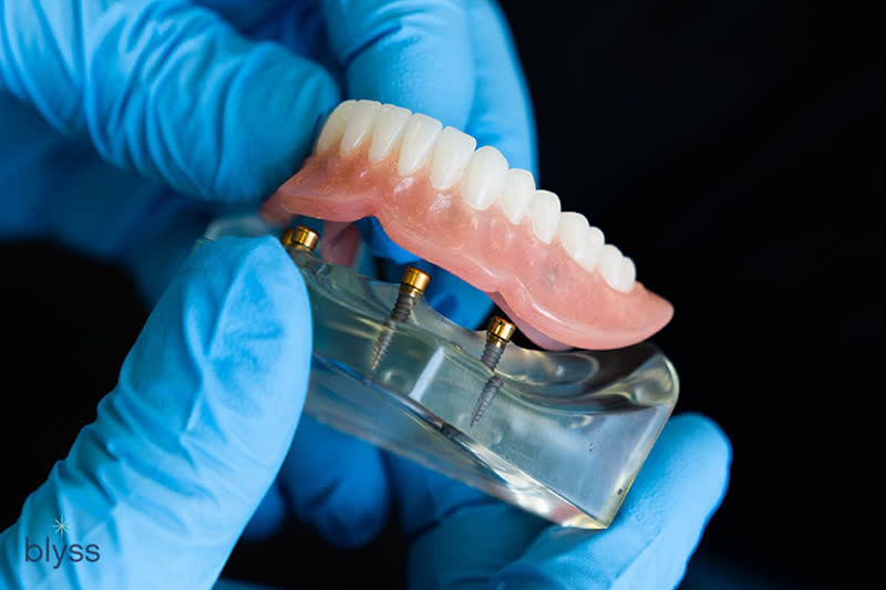 The image shows a person wearing gloves holding an upper denture with a clear plastic base and artificial teeth attached to it, against a dark background.