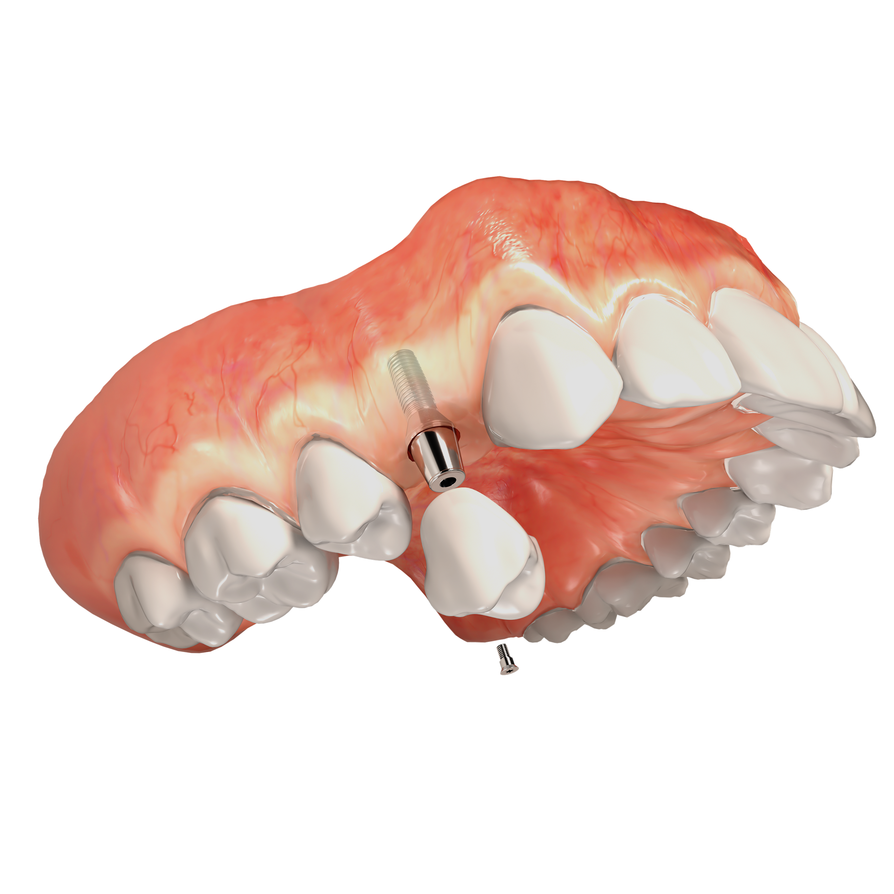 The image shows a 3D model of an open human mouth with prominent teeth and gums, displaying a detailed view of dental structures against a black background.