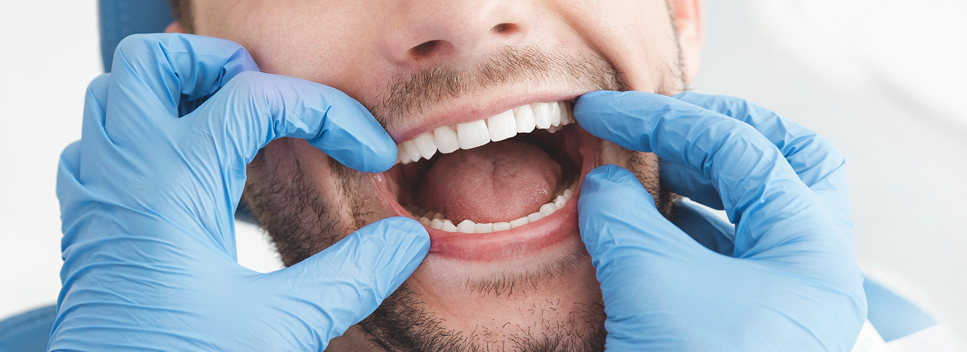 The image depicts a man with his mouth open wide, wearing blue gloves, likely in a dental or medical setting.