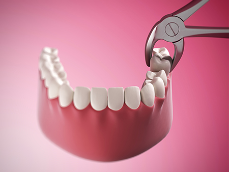 The image shows a close-up view of a dental implant fixture being screwed into place with a wrench, set against a pink background.
