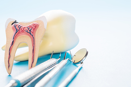 The image displays two side-by-side photographs featuring dental tools and a tooth model with a cavity and a toothbrush inserted into its bristles, highlighting oral health care practices.
